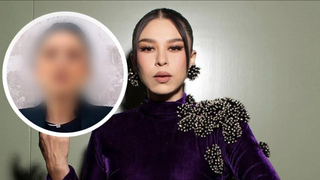 Denisse Guerrero deja en shock por el extraño aspecto de su rostro ¿Qué le pasó?