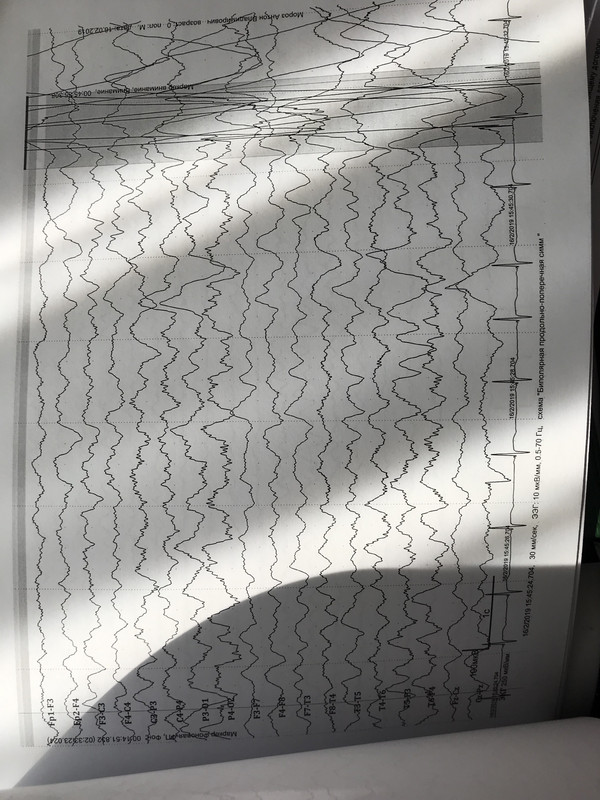 D91D65F9-4EC2-4661-A9A9-693FDA40AF7B