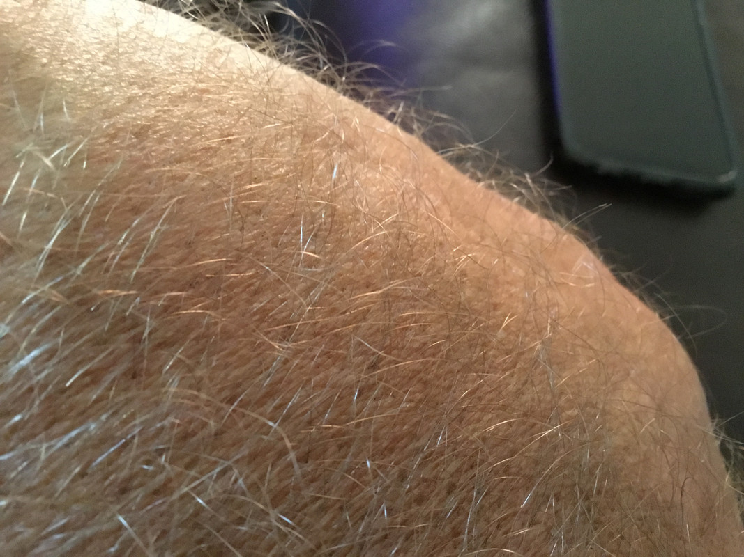 1F6DDD69-16CC-4102-83B5-87F43CD5B220