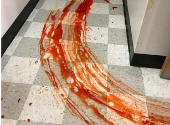fotosangre2