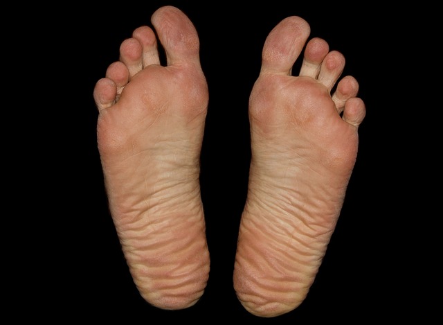 Fat Pad Injections In Feet Near Kansas City