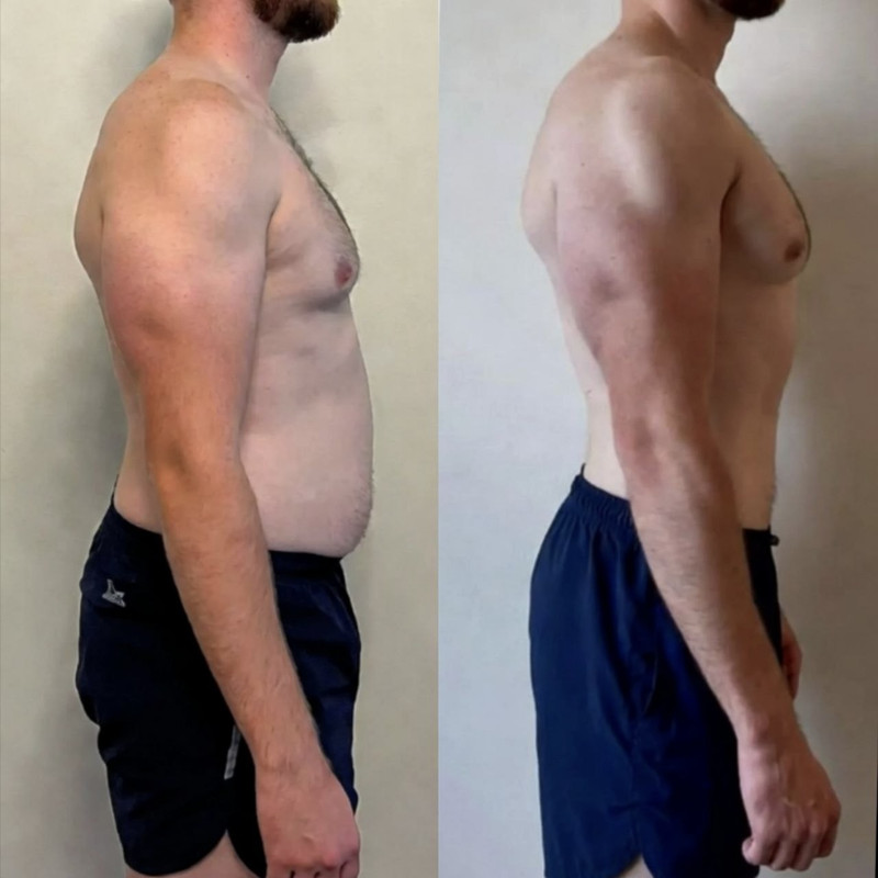 Клиент До и После 1