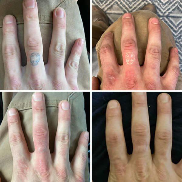 comparison-15