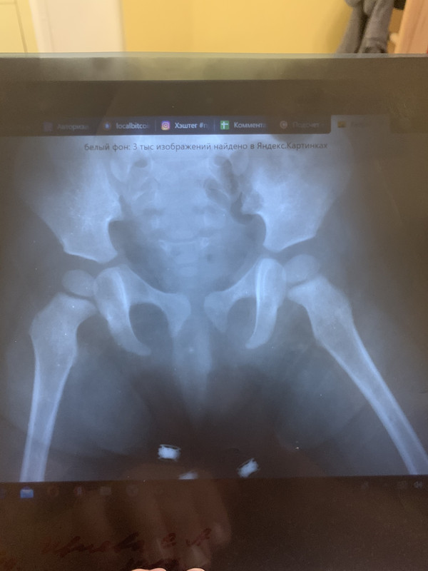 1A4A86DD-A738-4C1F-8E79-C38205A447E7