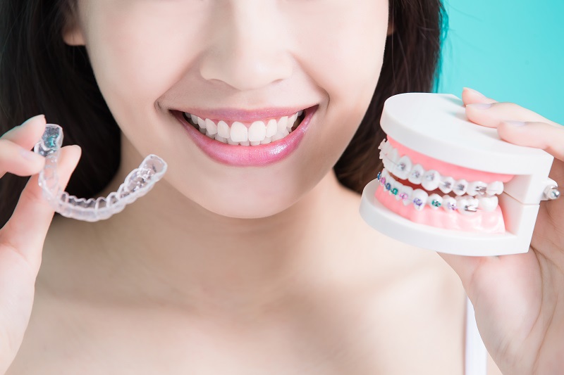 Why Should You Opt For Dental Invisalign Treatment?