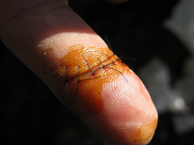 CUT-FINGER