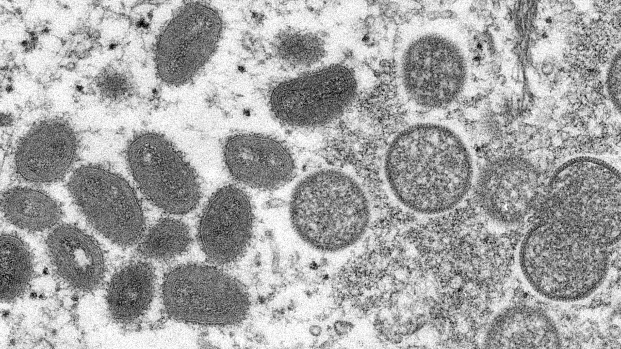 La OMS dice que no hay necesidad de vacunación masiva contra la viruela del mono