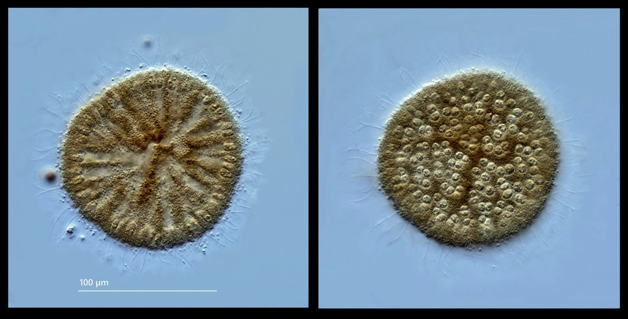 Spongomonas 01 (ev) uvella Wassertraube 2 gleich lange Geißeln (MikSap 112) DIK 50 Komp 2