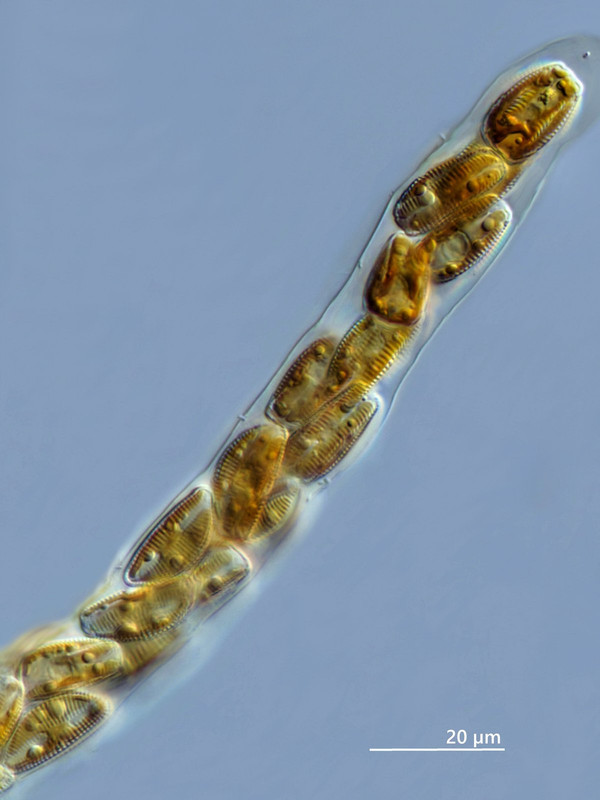 Cymbella 17 prostrata (jetzt Encyonema prostratum) Gerippte Kahn-Alge Gallertschlauch DIK 100 Stack 
