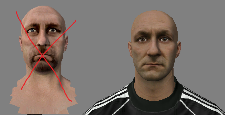 Barthez-lift.png