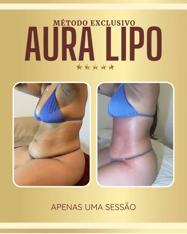 Resultados Aura Lipo - antes e depois