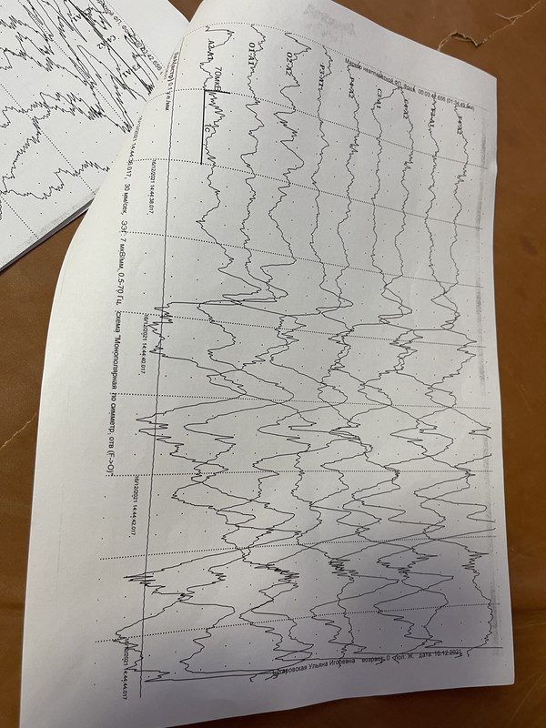 25A7A3B4-6DF1-40D7-8009-E5B0D34F9F01