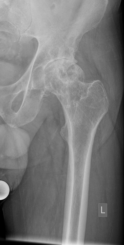 Hufte_LI_240930_1_Ausschnitt