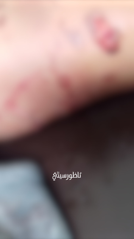 ALALI-L-00-16-57-02-Still010