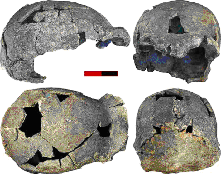 НадбровныеВаликиЭоектуса
