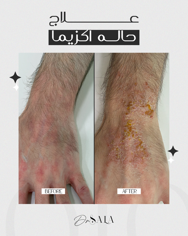 حالة قبل وبعد 4