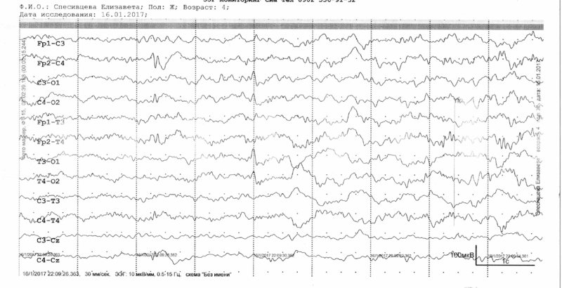 ЭЭГ01