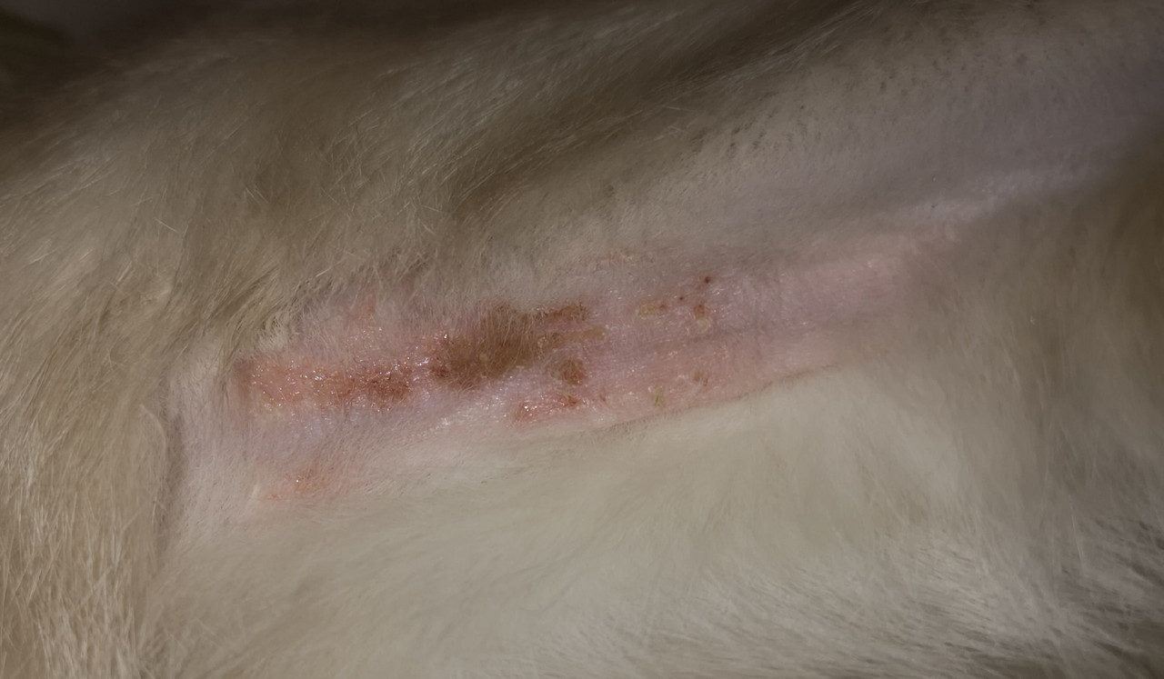 поражение на ноге