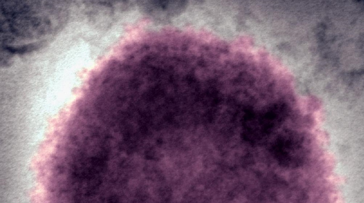 Estados Unidos reporta primeros casos de viruela del mono en niños