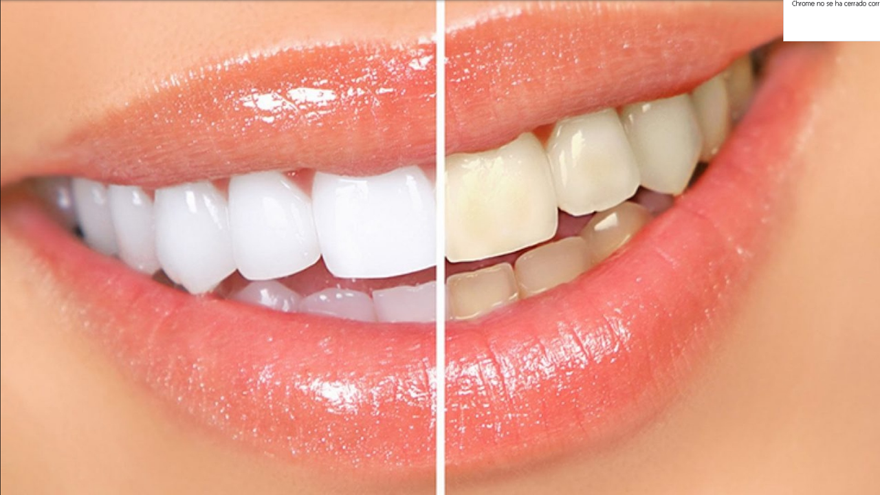 Blanquea tus dientes amarillos con salvia