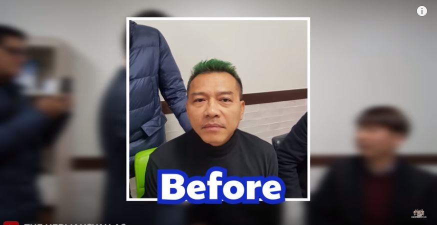 Wajah Anang sebelum pakai masker