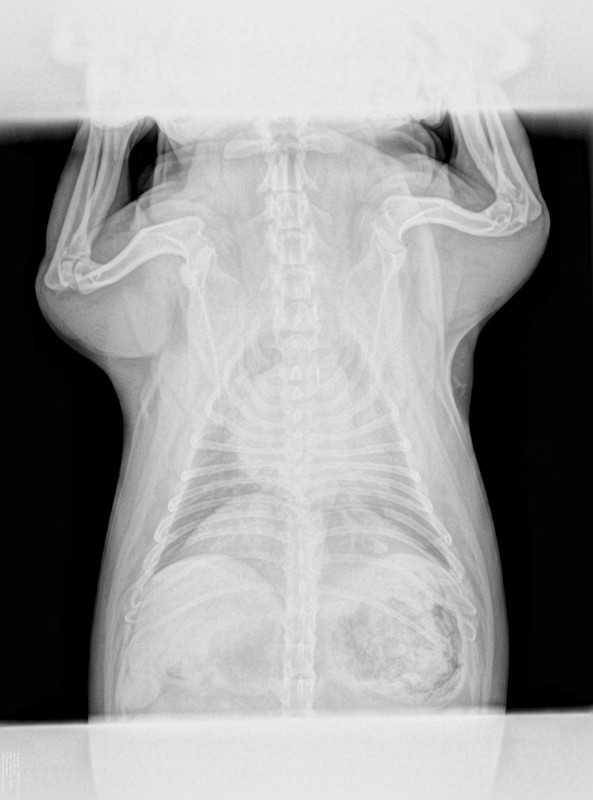 R-Thorax-Lateral#2