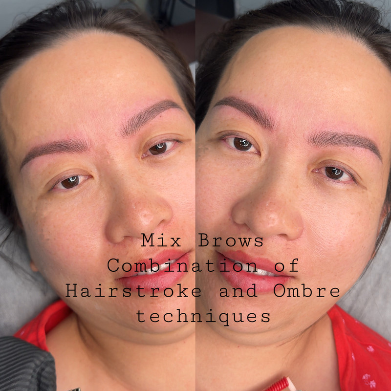 Eyebrow Enhancement Example New 3