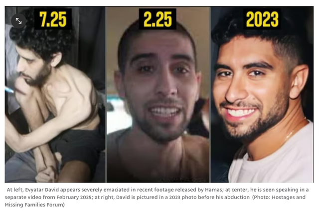 Evyatar-David-Before-and-After