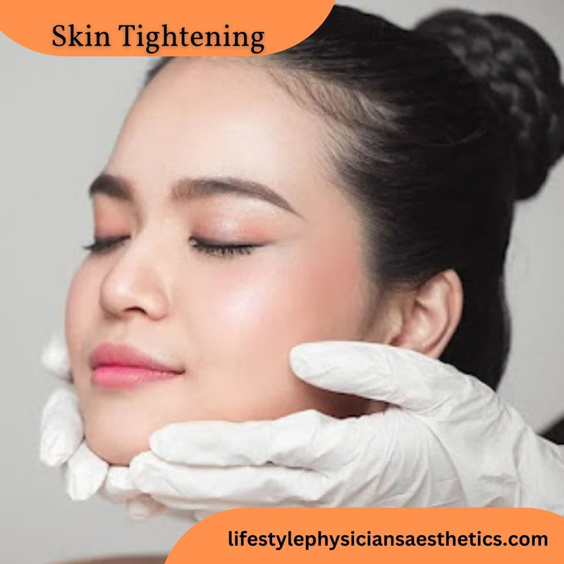 Skin tightening (1)