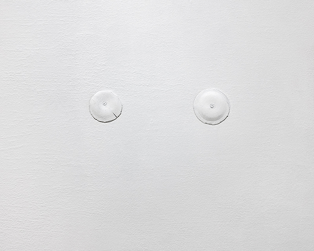 4 - приступ удушья