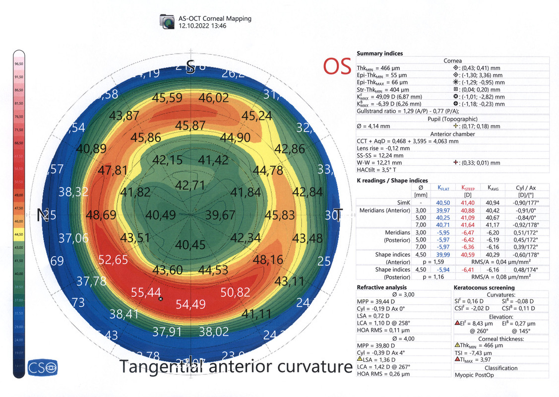 2022-10-12 - 07 AS-OCT Corneal Mapping, Tangential anterior curvature (OS)