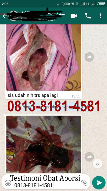 testimoni obat aborsi