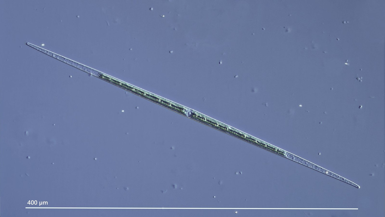 Closterium 55 (ev) aciculare Spindel-Alge Lenz I-32 DIK 40 Aurach-Moor-Z7