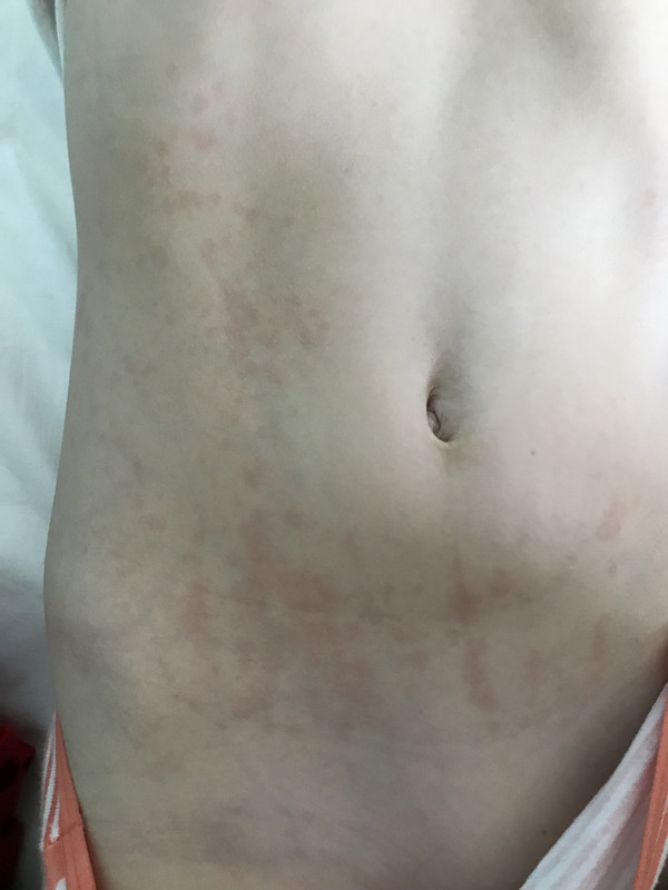 B556FE88-5EA2-4BA3-8589-00349BAA8581