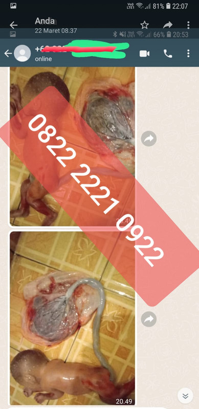 Jual obat aborsi cytotec asli, obat penggugur kandungan ampuh dan cara menggugurkan kandungan secara cepat
