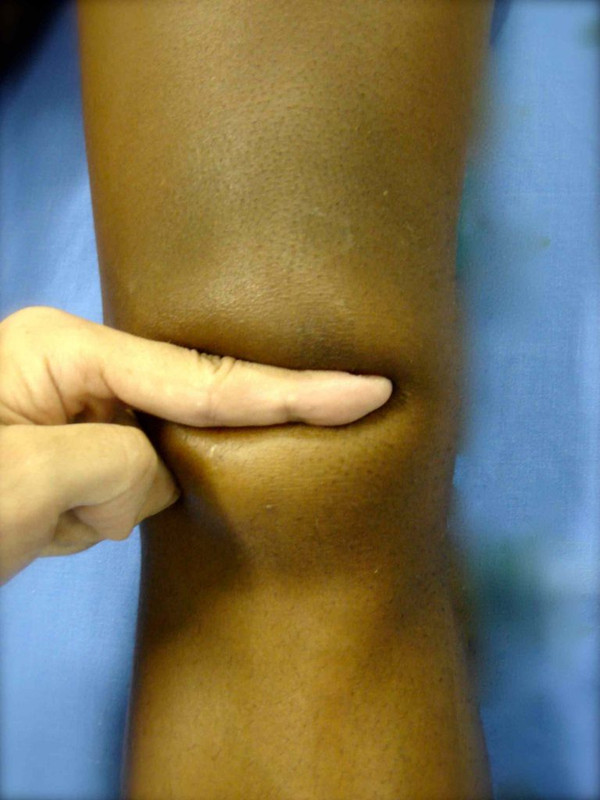 Aplicacao pomada CB2 no joelho