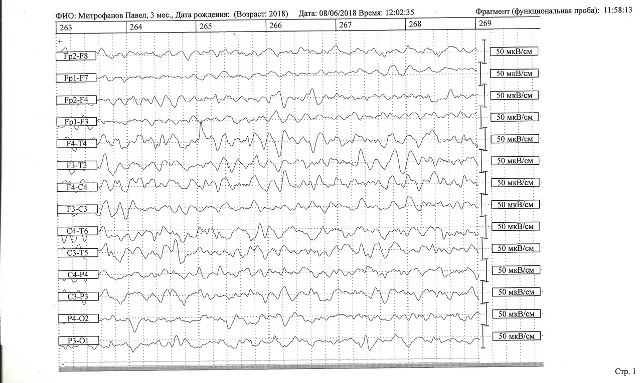 сканирование0005