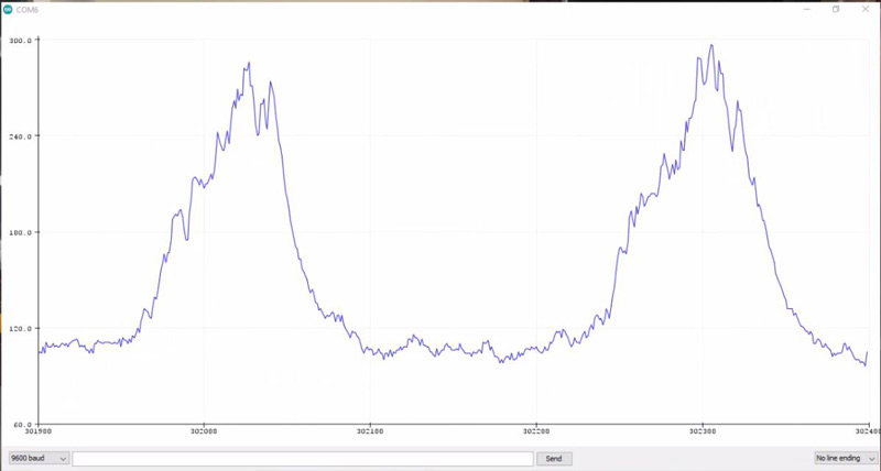 EMG-Result