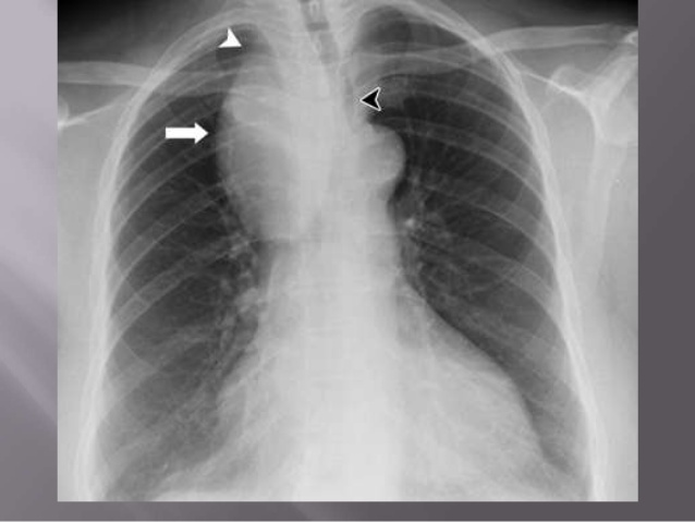 Neurology question 7 image