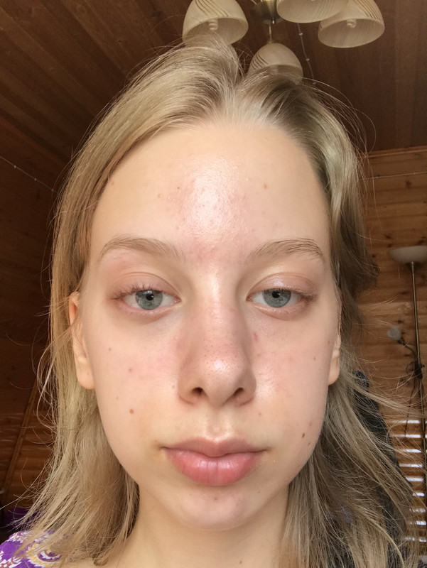 BD95D2F1-B80C-4816-890B-FDC6A9F4A65D