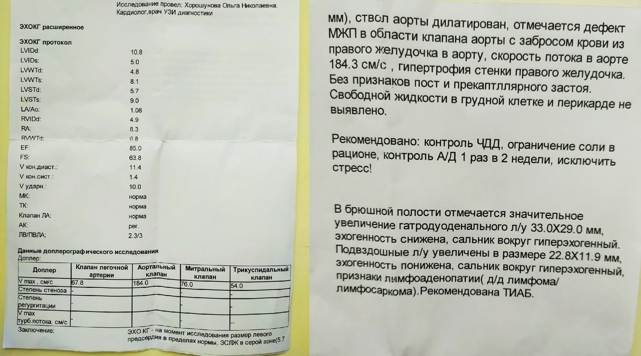 imgonline-com-ua-2to1-tNXbBNmCtm4TS