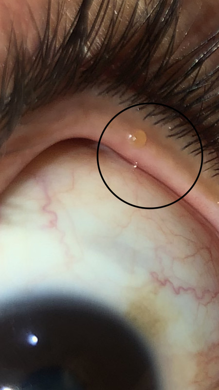 DF9B4C36-7F40-46FB-95D2-1EAA456F0777