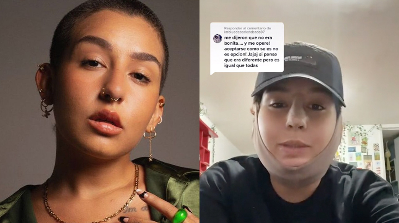 Así reaccionó Romina Marcos tras las críticas por reciente cirugía estética