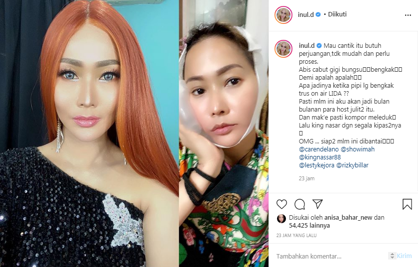 Inul Daratista cabut gigi bungsu