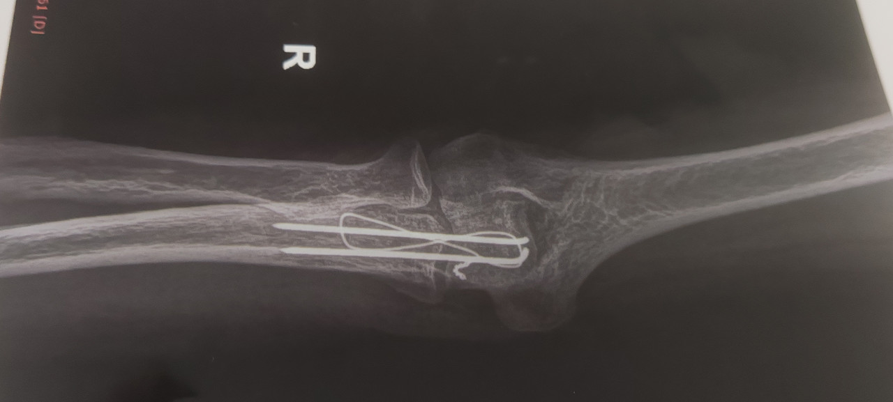xray2