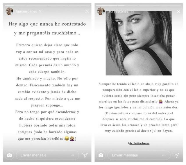 stories-antes-y-despues-labios-de-laura-escanes-1080x957