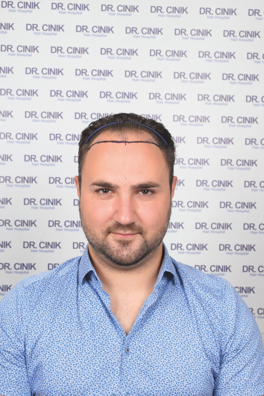 photos préopératoires (8)