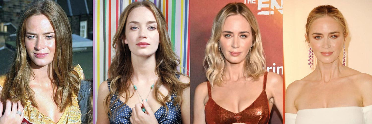 emily-blunt-plastic-surgery.jpg