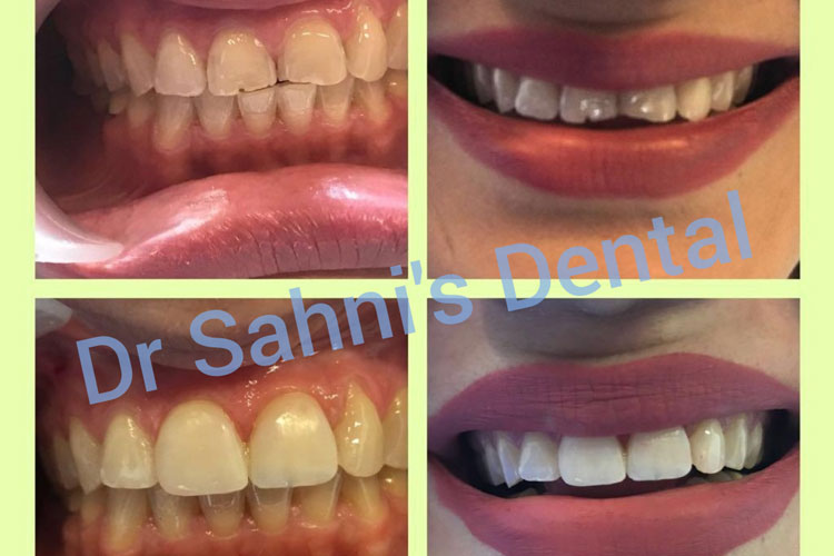 Dr Sahin Dental treatment
