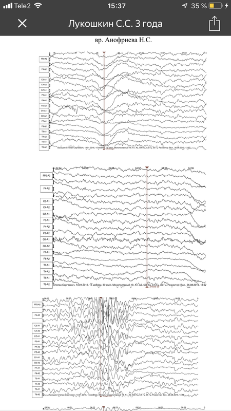 CC5F94E4-2A40-4E91-A002-AA9A45D247FC